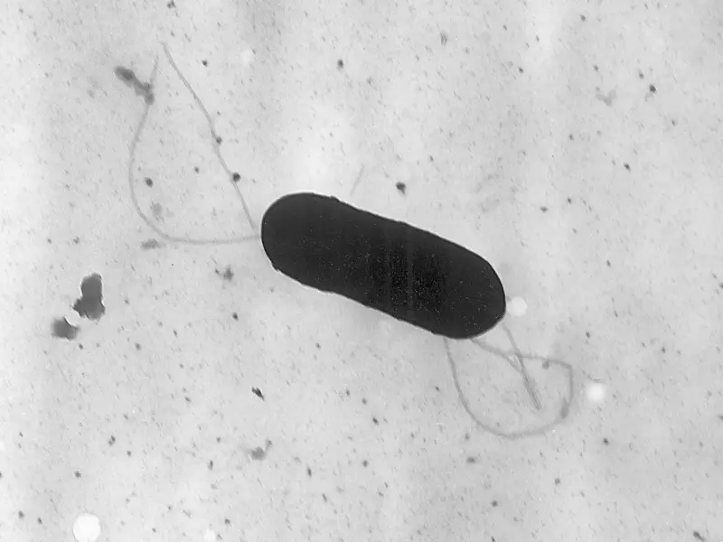 $6.5M Settlement Reached in Plant-Based Milk Listeria Outbreak