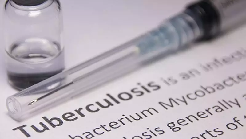 Edmonton Expands Tuberculosis Response After Inner-City Outbreak