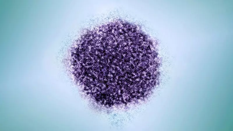 Hepatitis A Outbreak at Burlington Restaurant Confirmed by Health Officials