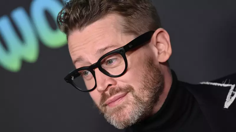 Macaulay Culkin Reveals Permanent Scar from Joe Pesci Bite in Home Alone
