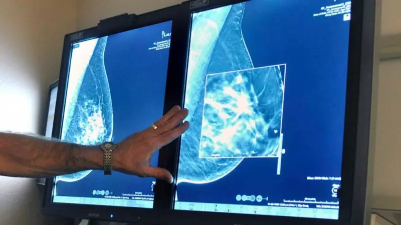 Mobile Mammography Service Brings Breast Screening to High River