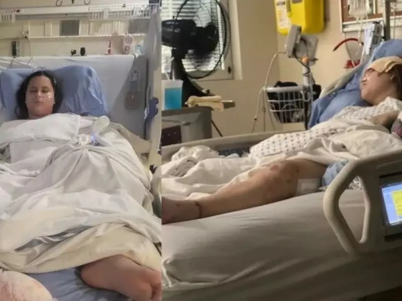 Sisters Recover in Separate Hospitals After Calgary Crosswalk Accident