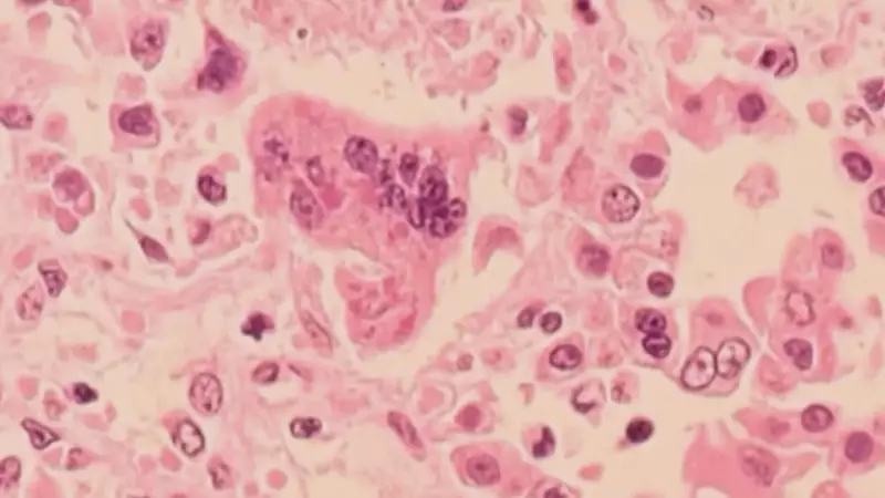 Winnipeg Health Officials Warn of 5 New Measles Exposure Sites