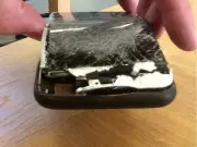 iPhone Fire Lawsuit: B.C. Man Sues Apple After Severe Burn Injury