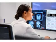 Philips and Cortechs.ai Expand Partnership to Advance AI Neuroimaging