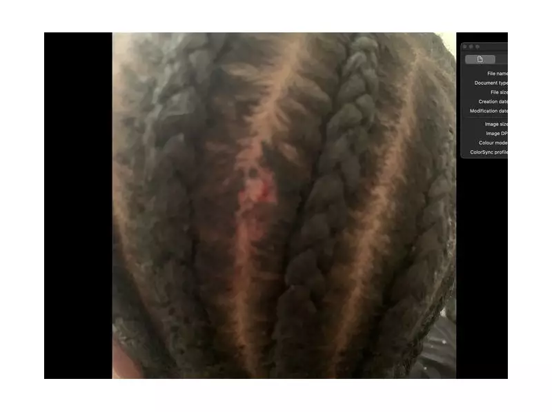 Drug Dealer Claims Self-Defence in Trial for Killing Toronto Mom with Stray Bullet