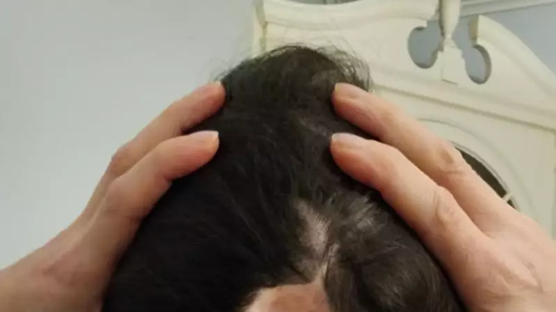 How a Cancer Survivor's Acupuncture Session Revealed Decades of Hidden Trauma