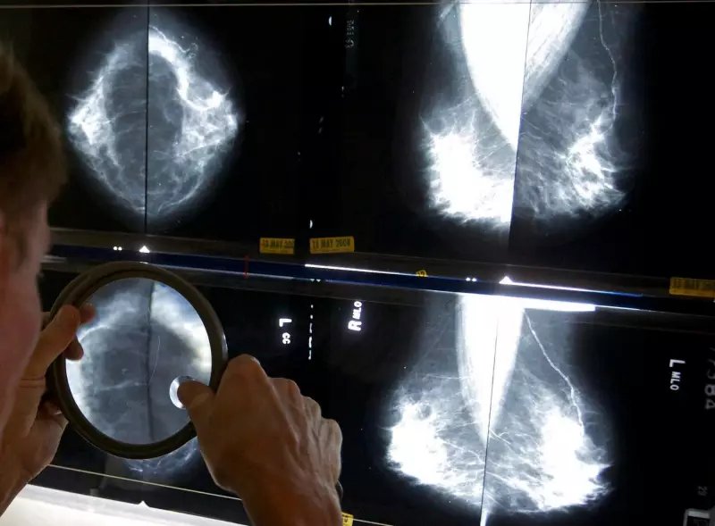 Study: Black Women Face 70% Higher Breast Cancer Mortality Rate