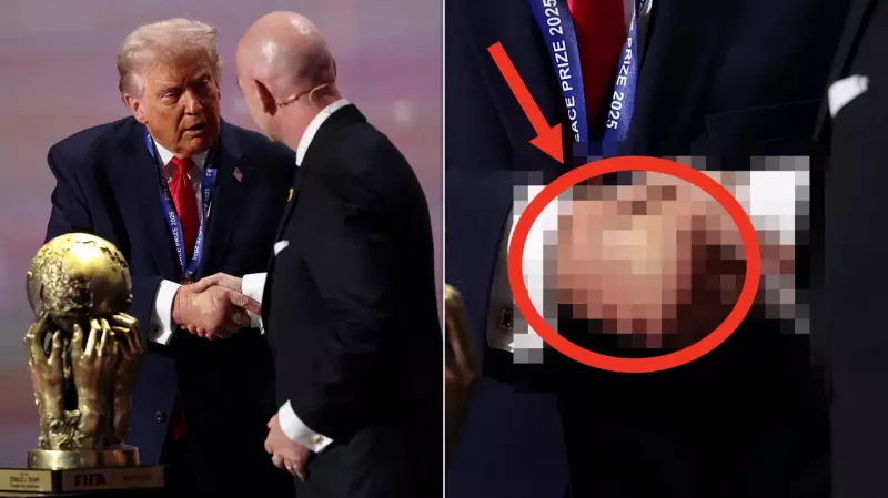 Trump's Bruised Hand Sparks Health Questions at FIFA Event