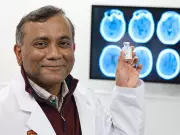 Calgary Stroke Study Changes Global Drug Guidelines, Saving Critical Minutes