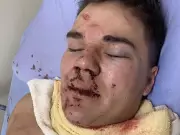 Judge Spares Convicted Killer Prison Term in Banff Stabbing, Cites 'Near Self-Defence'