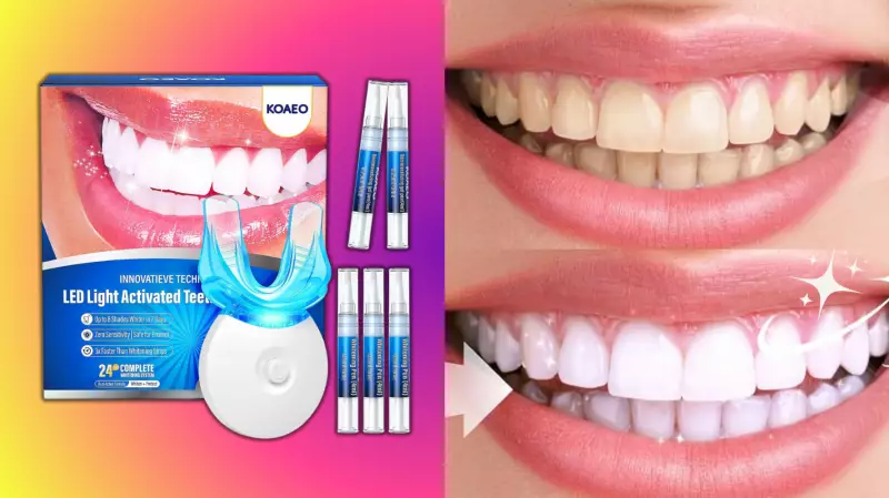 Amazon's Affordable Teeth Whitening Kit Delivers Professional Results Without Sensitivity