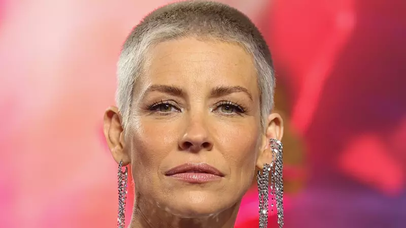 Evangeline Lilly Reveals Brain Damage from Concussion: 'Functioning at Decreased Capacity'