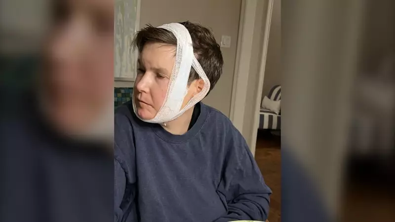 Mother: Son 'Savagely Bitten' at Toronto Group Home During Staff Strike