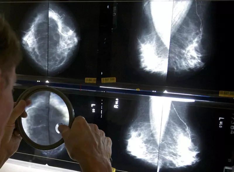 Saskatchewan Lowers Breast Cancer Screening Age to 43 in 2026