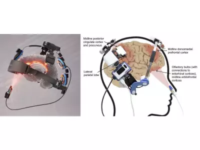 Breakthrough Study: Red-Light Therapy Shows Promise in Protecting Football Players' Brain Health