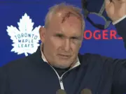 Maple Leafs Coach Craig Berube Shows Off Gym Injury Battle Scars