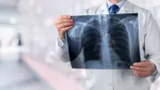 Pneumonia Deaths Surge 20% in Canada, New StatCan 2024 Data Reveals