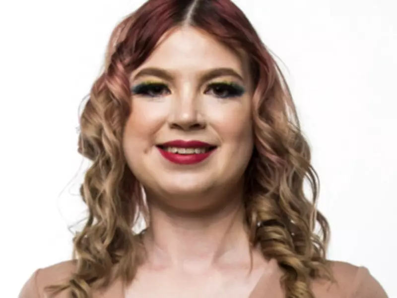 Autistic Model Kelsey-Rose Aims to Inspire Others on the Spectrum