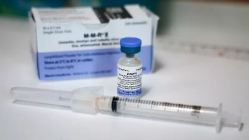 Measles Exposure Advisory Issued Across Parkland County, Alberta