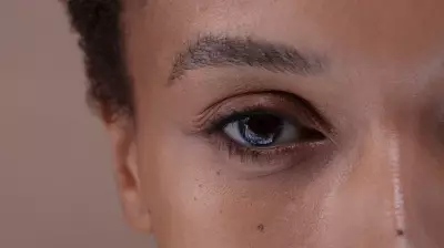 Ophthalmologist's Critical Warning: The One Thing You Must Never Do With Contact Lenses