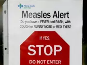 Parkland County Added to Alberta's Standing Measles Exposure Alert List