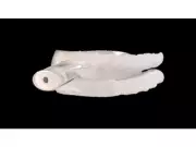 TAP Sleep Care's Dual Therapy: Mouth Shield + TAP Enhances Health in Sleep Apnea