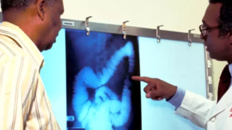 Advocates Urge Canada to Lower Colorectal Cancer Screening Age