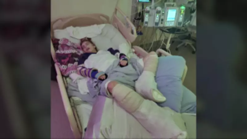 B.C. Teen with Special Needs Suffers Severe Burns in Bath While in Ministry Care