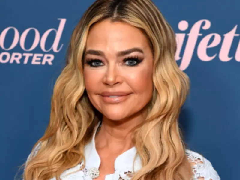 Denise Richards Unveils Dramatic Facelift Transformation in Shocking Before-and-After Photos