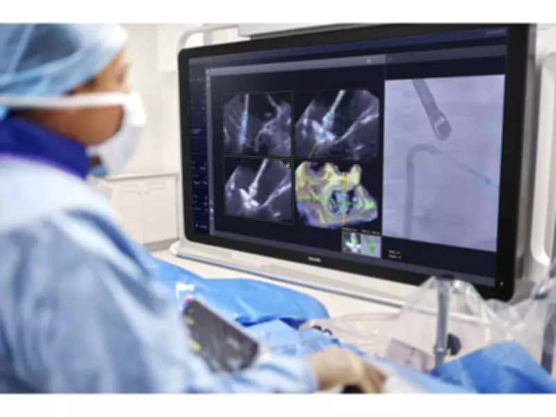 FDA Clears Philips AI Solution for Real-Time Guidance in Complex Heart Valve Repair