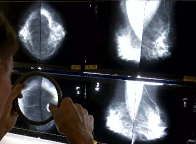 Global Breast Cancer Cases Projected to Surpass 3.5 Million by 2050, Study Warns