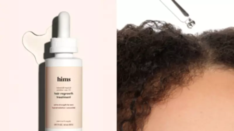 Key Ingredients for Hair Loss Products: Minoxidil Leads Expert Recommendations