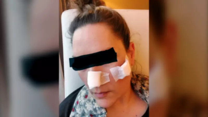 Ontario Denies Funding, Woman Spends $30K in U.S. for Tissue-Destroying Disease Diagnosis