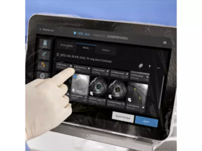 Philips Unveils IntraSight Plus Platform to Revolutionize Coronary Interventions