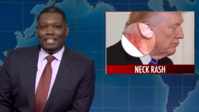 SNL's Weekend Update Mocks Trump's Neck Rash and Noem Firing