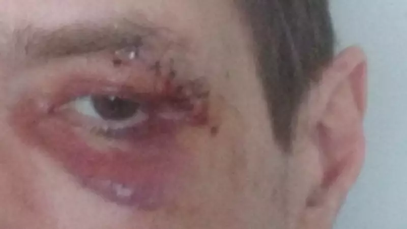 Toronto Man Assaulted in Random Attack, Suspect Allegedly Struck Another Minutes Before