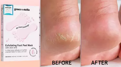 Amazon Users Rave About Affordable Foot Peel Masks That Deliver Baby-Soft Feet