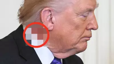 Dermatologists Analyze Trump's Neck Rash, Suggest Common Skin Treatment
