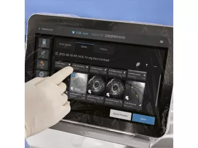Philips Unveils IntraSight Plus Platform to Revolutionize Coronary Interventions