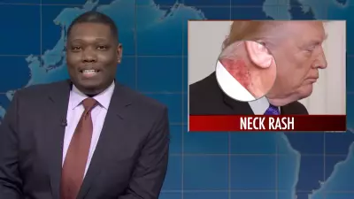 SNL's Weekend Update Mocks Trump's Neck Rash and Noem Firing