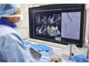 FDA Clears Philips AI Solution for Real-Time Guidance in Complex Heart Valve Repair