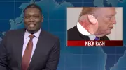 SNL's Weekend Update Mocks Trump's Neck Rash and Noem Firing