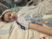 Tumbler Ridge Victim Maya Gebala to Undergo Fourth Surgery for Skull Prosthetic