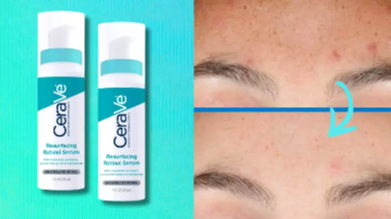 CeraVe's Resurfacing Retinol Serum: A BOGO 50% Off Deal on Amazon