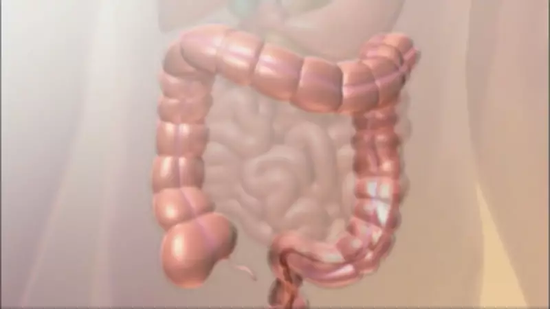 Colorectal Cancer Prevention: Essential Screening Guidelines and Steps