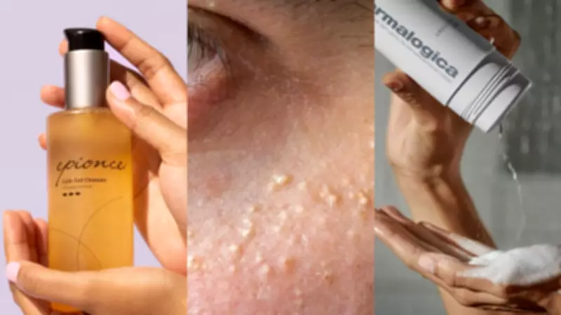 Expert Dermatologist Reveals Top Products to Prevent Milia Skin Condition