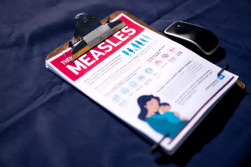 Measles Silent Spread in U.S. Threatens Elimination Status, New Tests Show