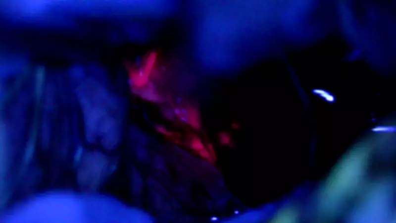 Ottawa Hospital's 'Pink Drink' Illuminates Cancer Detection Breakthrough