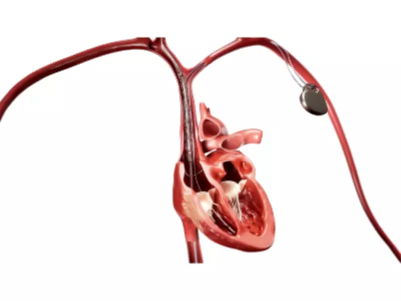 Philips Launches Bridge Plus Balloon for Rare SVC Tear Emergencies